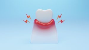 gum pain relief and management